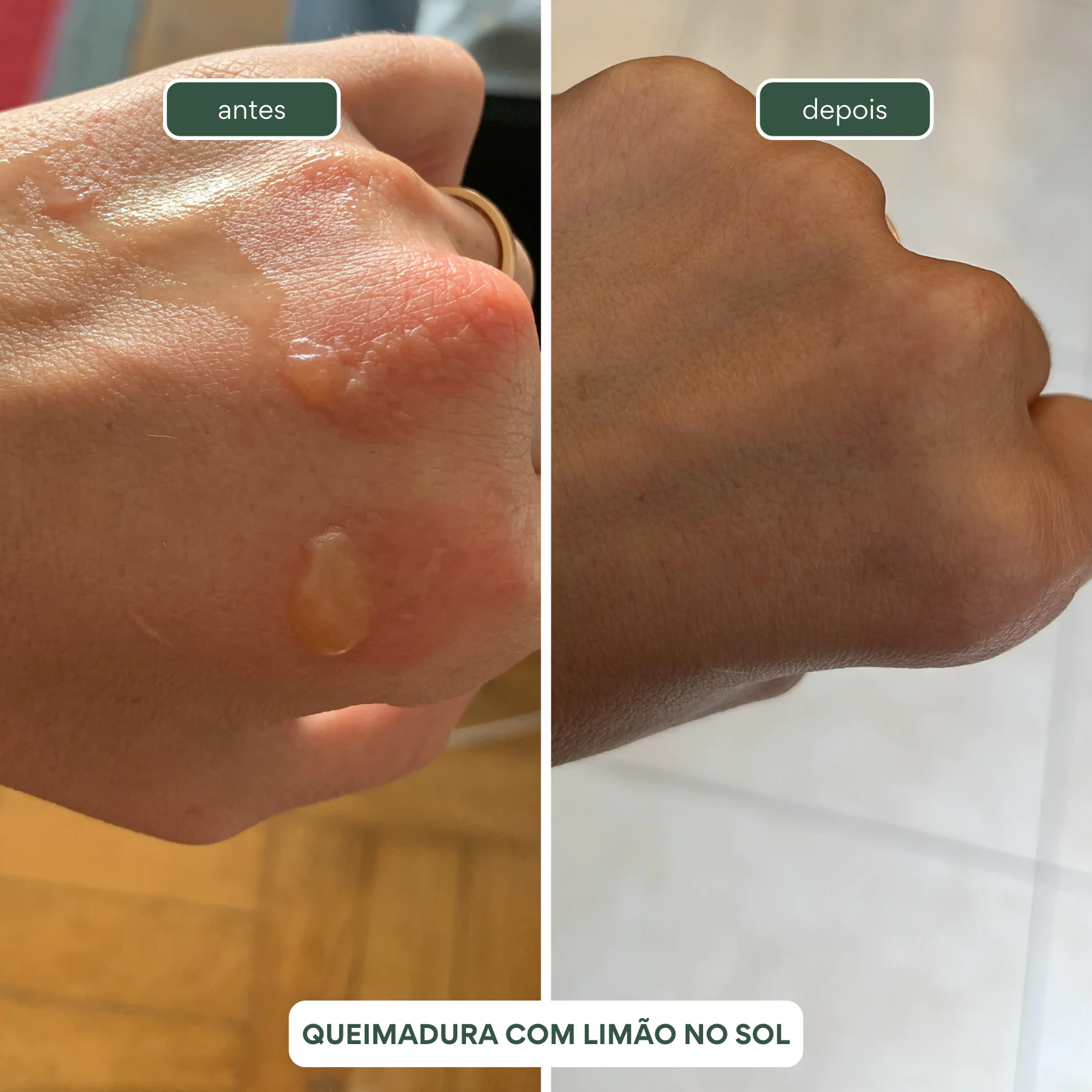 1 Gel de Aloe Vera Multifuncional BABOSA 250ml - Imagem 7