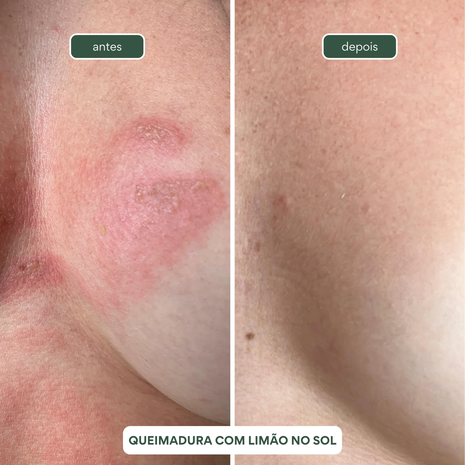 4 Gel de Aloe Vera Multifuncional BABOSA 250ml - Imagem 6