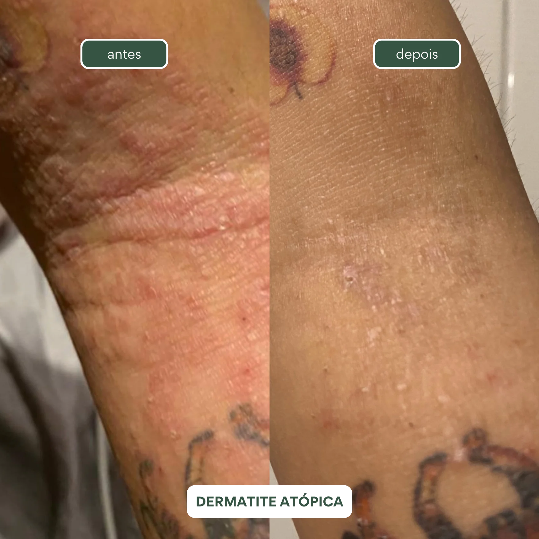 Manteiga Hidratante Corporal SUAVIDADE 250g - Pracaxi e Andiroba - Imagem 6