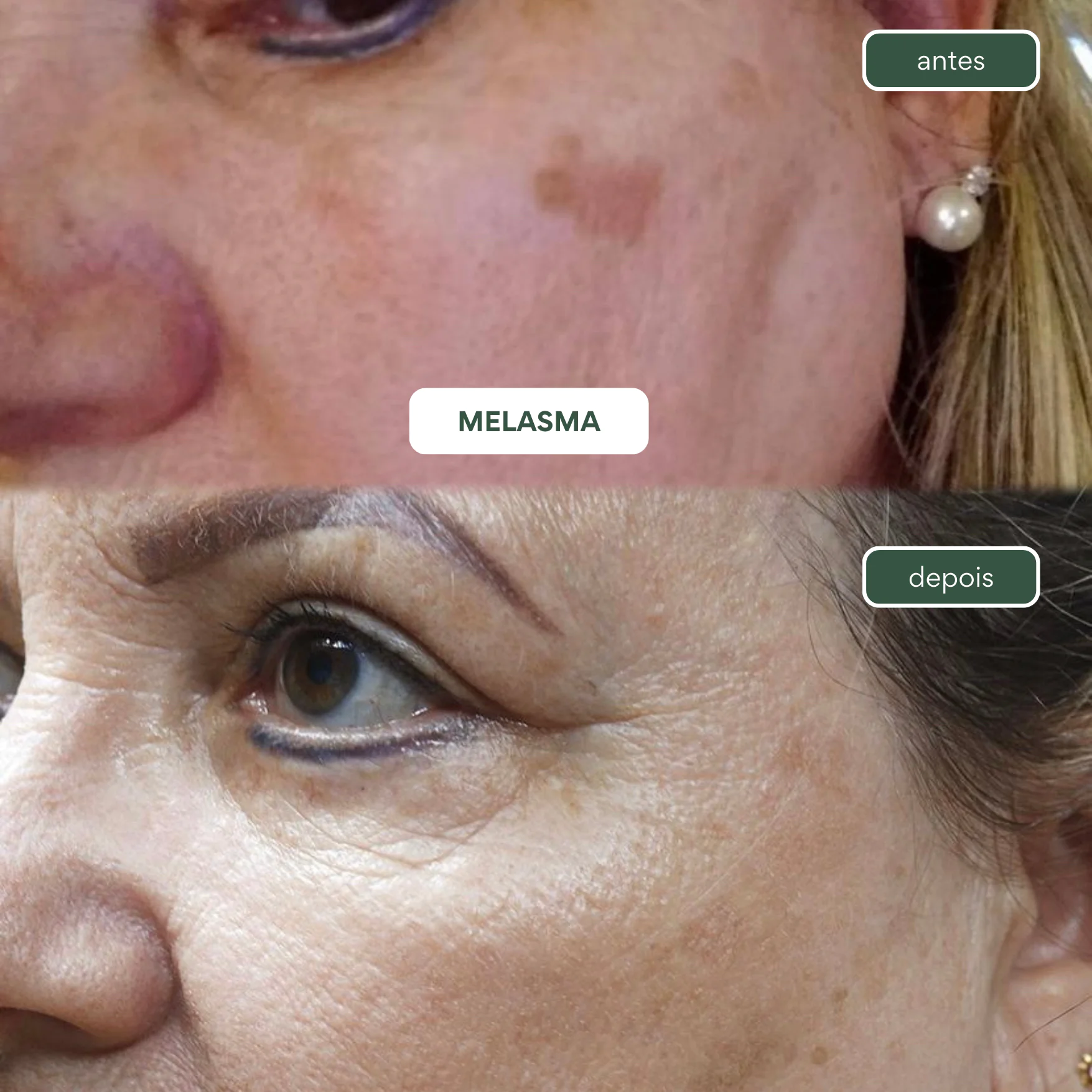 Kit manchas e sinais (Aloe Micelar, Revitalizante e Orvalho) - Imagem 5